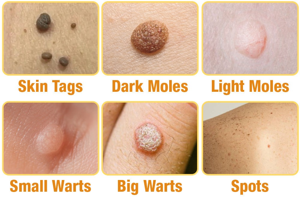 TagRecede Bee Venom Treatment Spray