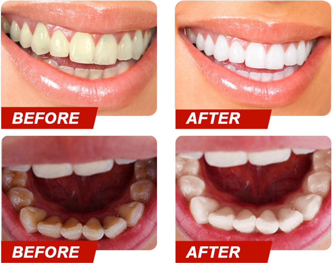 Teeth Color Corrector Serum